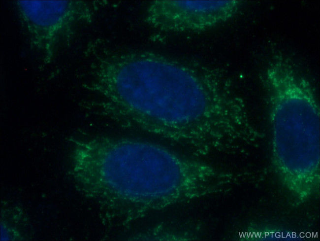 Interferon beta Antibody in Immunocytochemistry (ICC/IF)