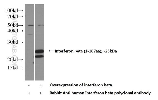 Interferon beta Antibody in Western Blot (WB)