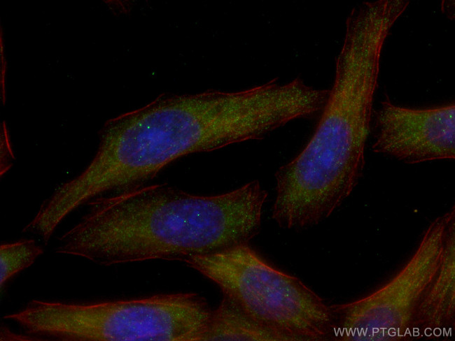 Interferon beta Antibody in Immunocytochemistry (ICC/IF)