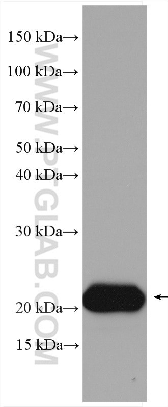 Interferon beta Antibody in Western Blot (WB)