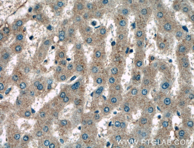 KLK15 Antibody in Immunohistochemistry (Paraffin) (IHC (P))