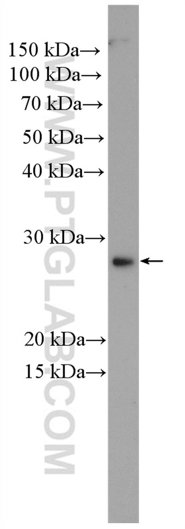 KLK15 Antibody in Western Blot (WB)