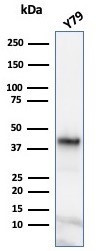 Glutamine Synthetase/GLUL Antibody in Western Blot (WB)