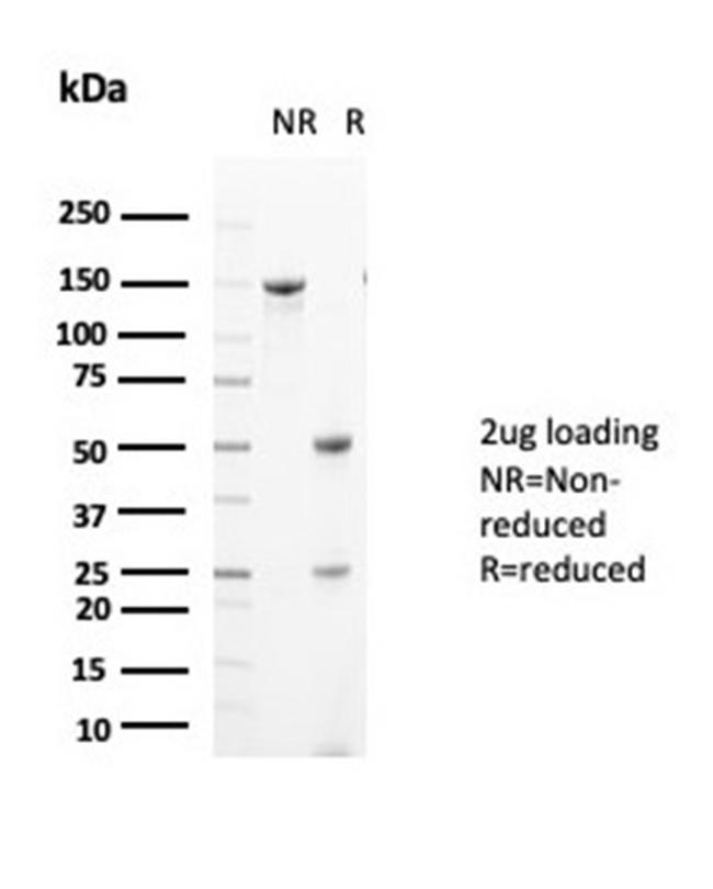 Glutamine Synthetase/GLUL Antibody in Immunoelectrophoresis (IE)