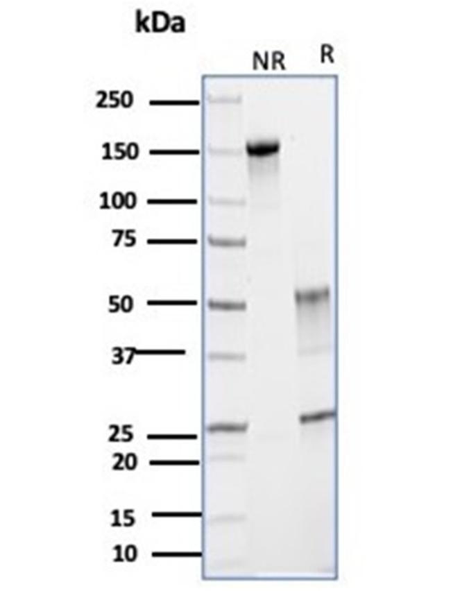 Glutamine Synthetase/GLUL Antibody in Immunoelectrophoresis (IE)