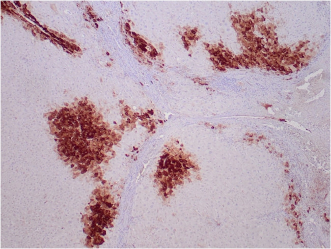 Glutamine Synthetase/GLUL Antibody in Immunohistochemistry (Paraffin) (IHC (P))