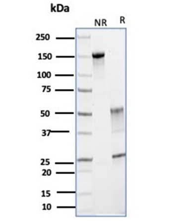 Glutamine Synthetase/GLUL Antibody in SDS-PAGE (SDS-PAGE)