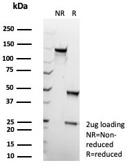 Glutamine Synthetase/GLUL Antibody in SDS-PAGE (SDS-PAGE)