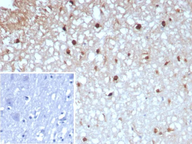 Glutamine Synthetase/GLUL Antibody in Immunohistochemistry (Paraffin) (IHC (P))