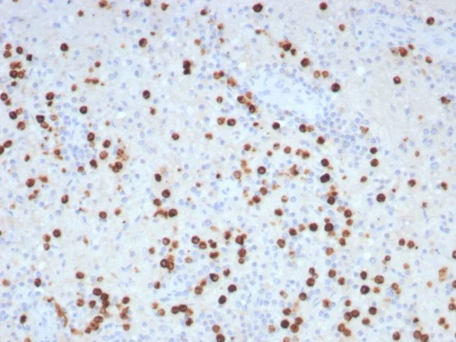 Glutamine Synthetase/GLUL Antibody in Immunohistochemistry (Paraffin) (IHC (P))