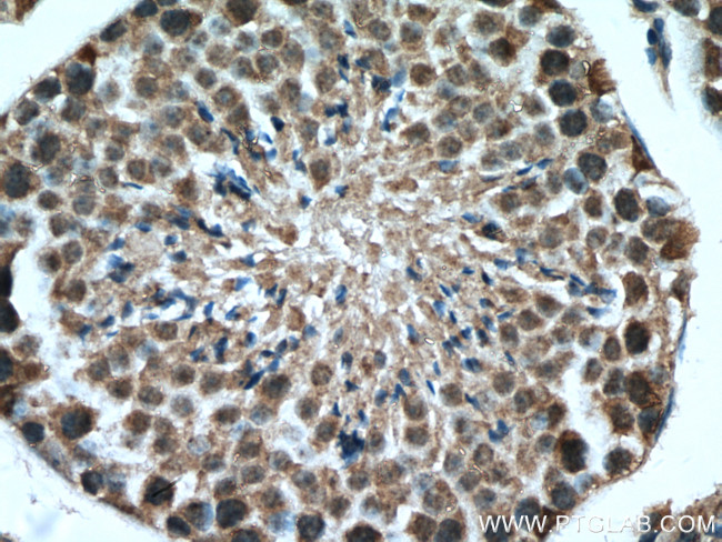 USP29 Antibody in Immunohistochemistry (Paraffin) (IHC (P))