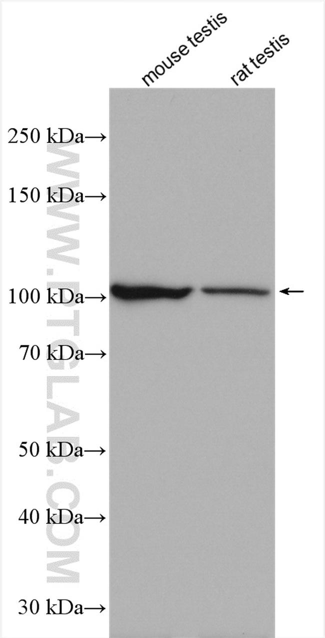 USP29 Antibody in Western Blot (WB)