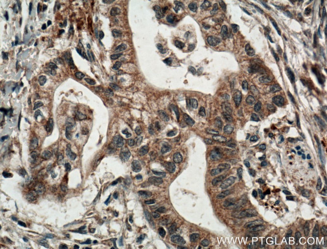 IRE1/ERN1 Antibody in Immunohistochemistry (Paraffin) (IHC (P))