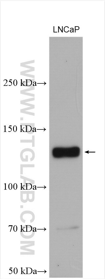 IRE1/ERN1 Antibody in Western Blot (WB)