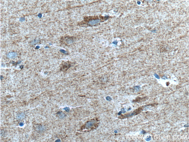 SYNDIG1 Antibody in Immunohistochemistry (Paraffin) (IHC (P))