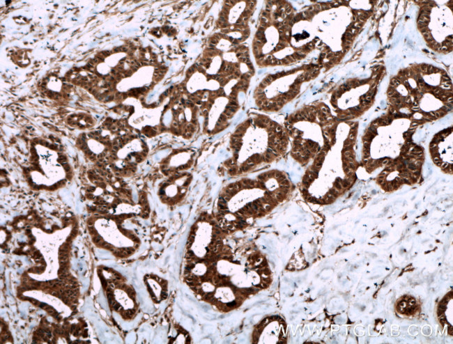 Livin Antibody in Immunohistochemistry (Paraffin) (IHC (P))