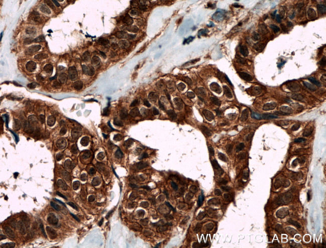 Livin Antibody in Immunohistochemistry (Paraffin) (IHC (P))