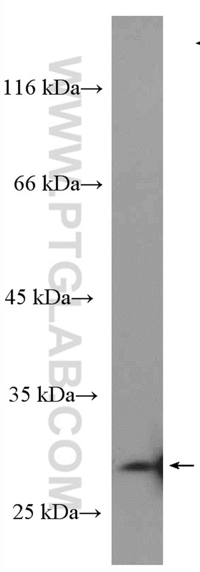 Livin Antibody in Western Blot (WB)