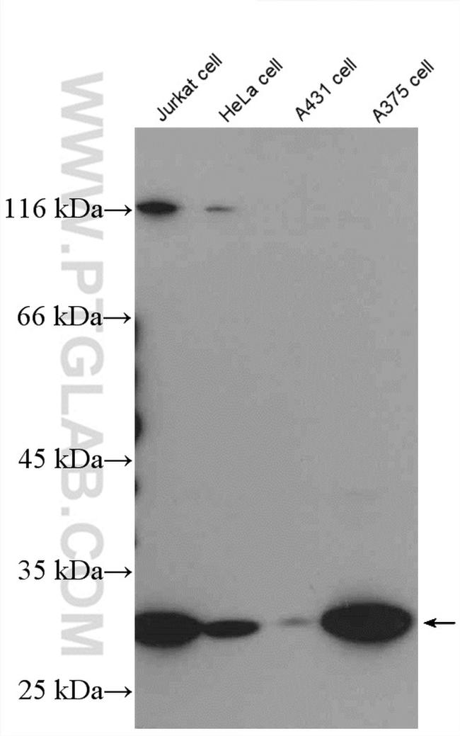 Livin Antibody in Western Blot (WB)