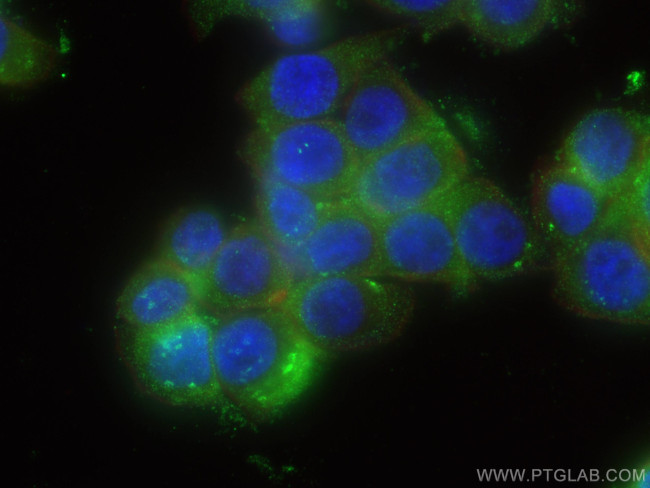 Galectin-4 Antibody in Immunocytochemistry (ICC/IF)