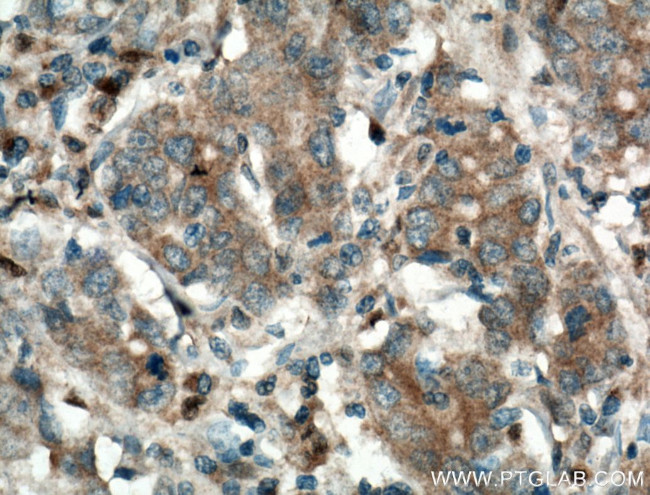 Galectin-4 Antibody in Immunohistochemistry (Paraffin) (IHC (P))