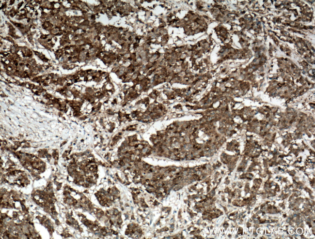 Galectin-4 Antibody in Immunohistochemistry (Paraffin) (IHC (P))