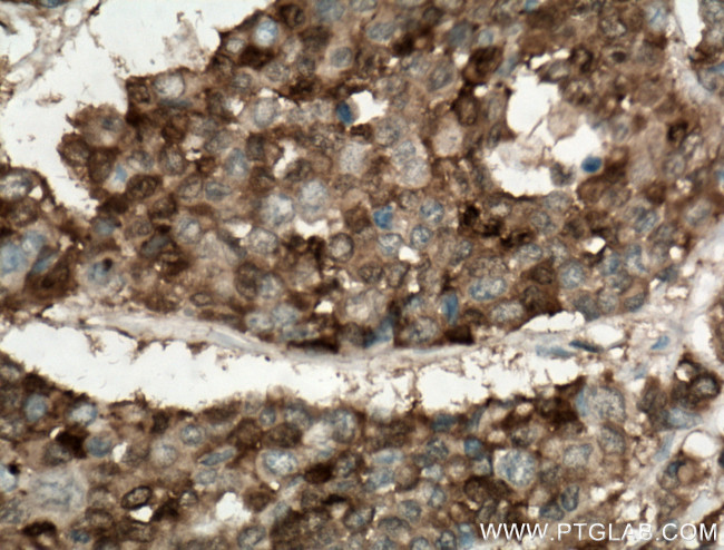 Galectin-4 Antibody in Immunohistochemistry (Paraffin) (IHC (P))