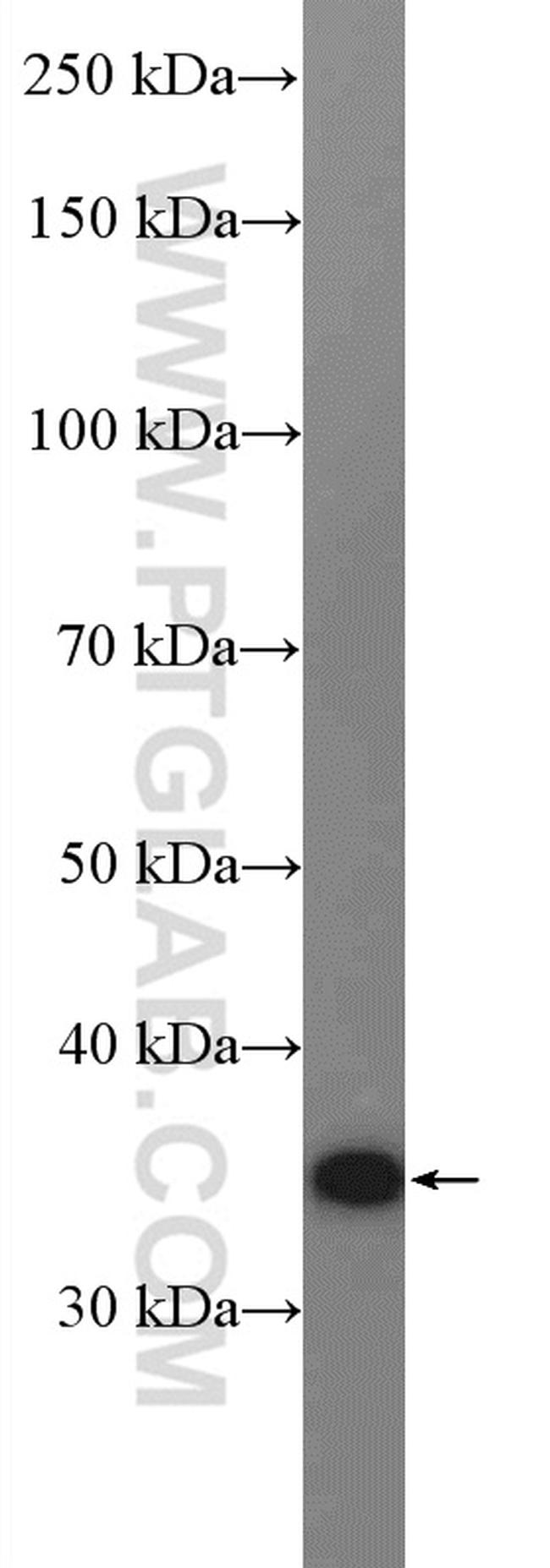 Galectin-4 Antibody in Western Blot (WB)