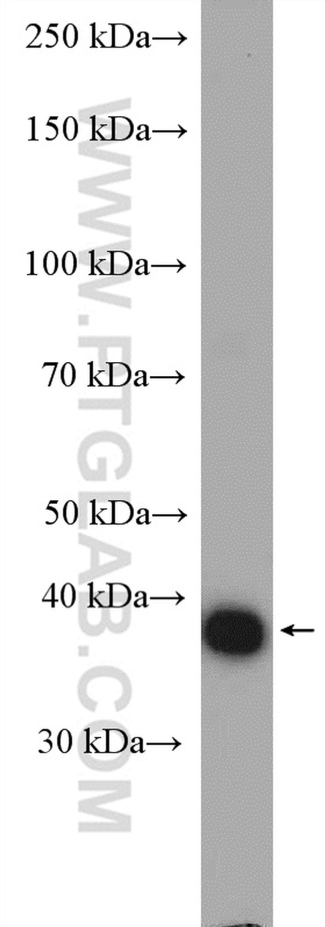 Galectin-4 Antibody in Western Blot (WB)