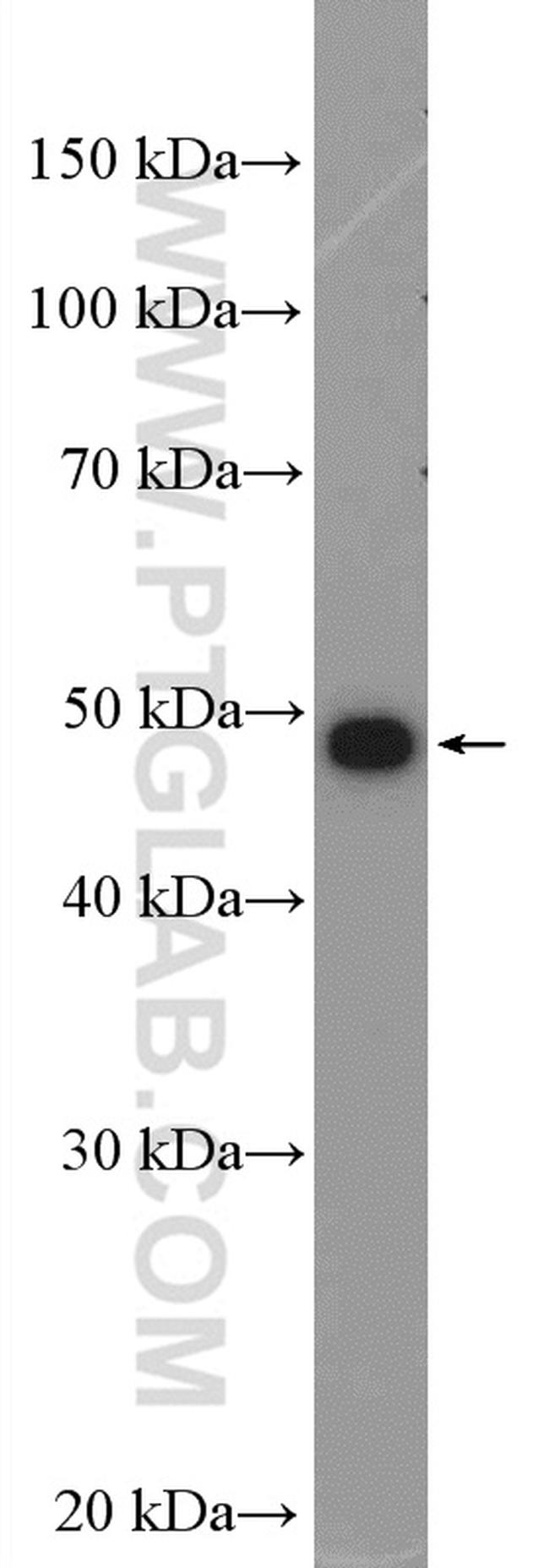 AKD2 Antibody in Western Blot (WB)