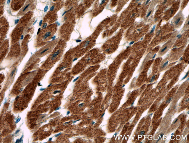 AKD2 Antibody in Immunohistochemistry (Paraffin) (IHC (P))