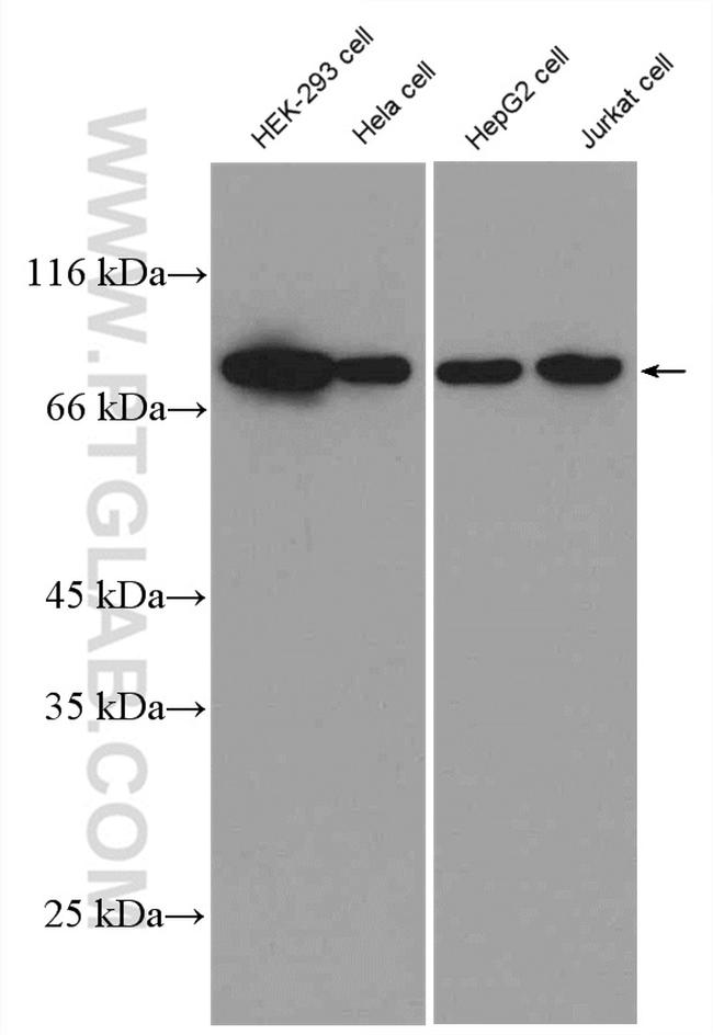 Alpha taxilin Antibody in Western Blot (WB)