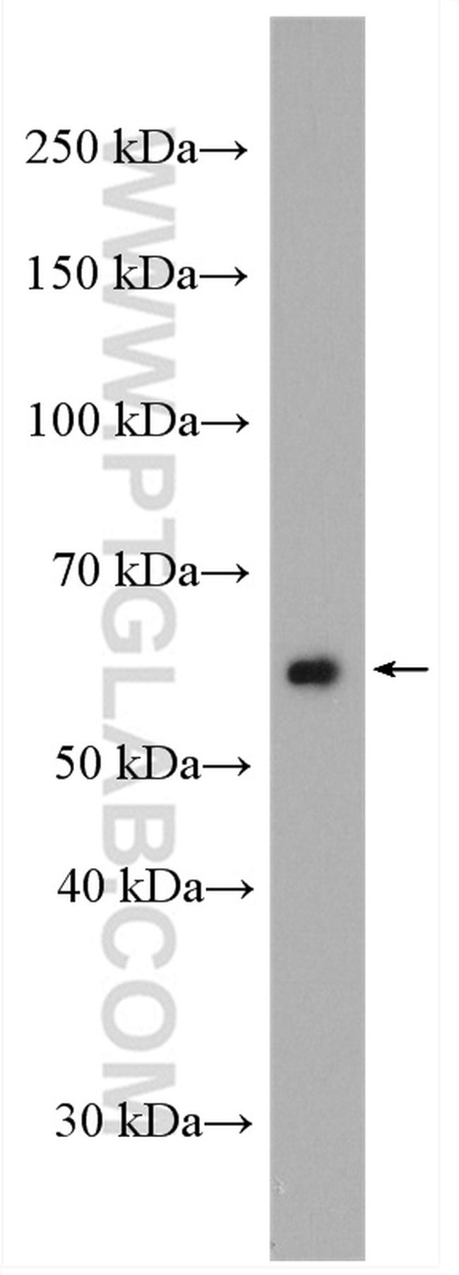 GLUT5 Antibody in Western Blot (WB)