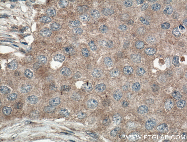 GLUT5 Antibody in Immunohistochemistry (Paraffin) (IHC (P))