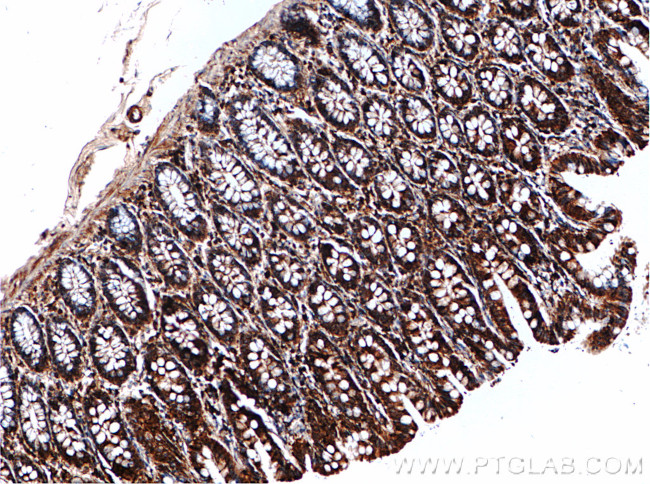 ARPM1 Antibody in Immunohistochemistry (Paraffin) (IHC (P))