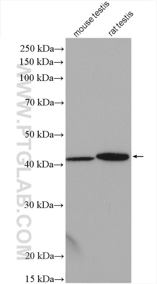 ARPM1 Antibody in Western Blot (WB)