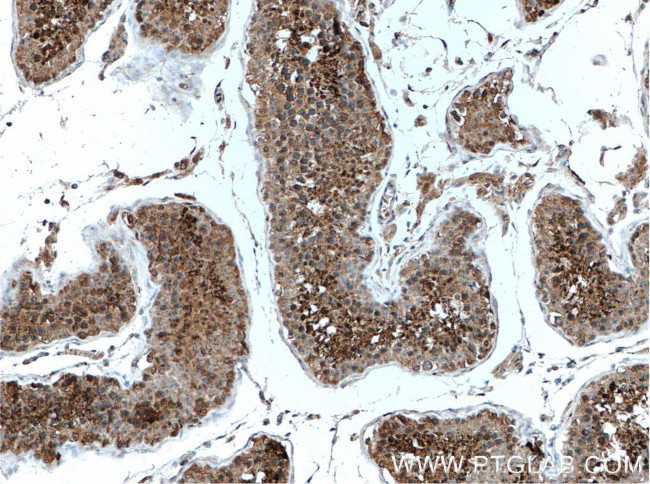 ARPM1 Antibody in Immunohistochemistry (Paraffin) (IHC (P))