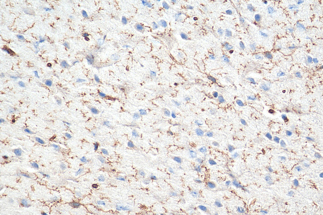 TMEM119 Antibody in Immunohistochemistry (Paraffin) (IHC (P))