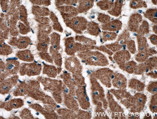 RYR2 Antibody in Immunohistochemistry (Paraffin) (IHC (P))