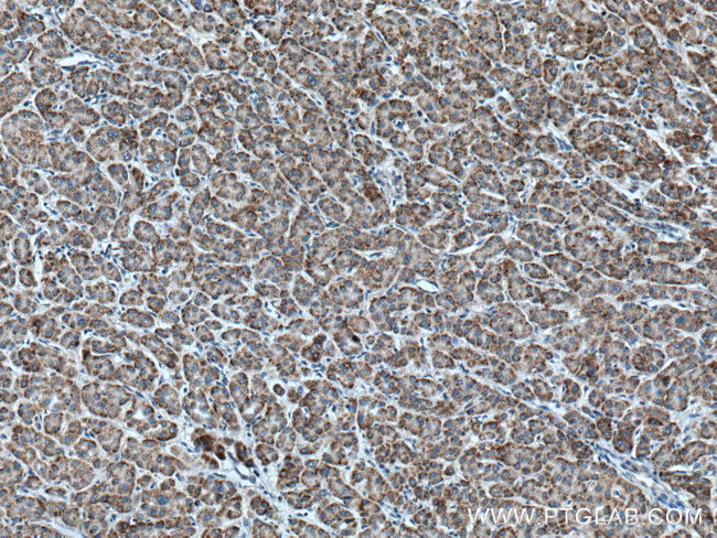 RACK1/GNB2L1 Antibody in Immunohistochemistry (Paraffin) (IHC (P))