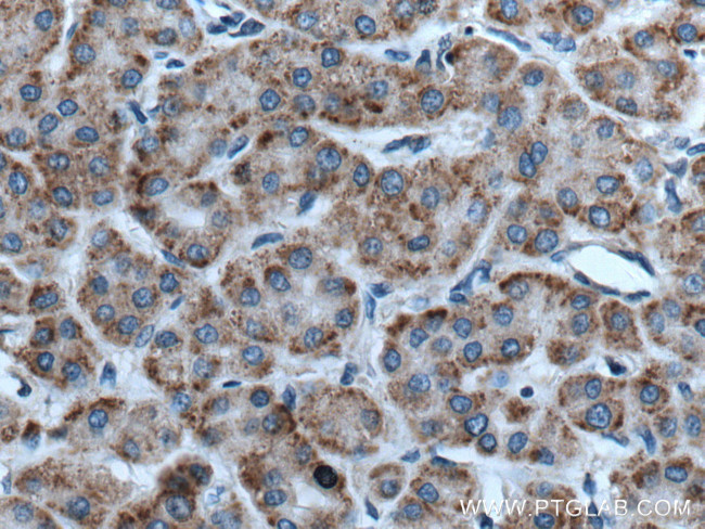 RACK1/GNB2L1 Antibody in Immunohistochemistry (Paraffin) (IHC (P))