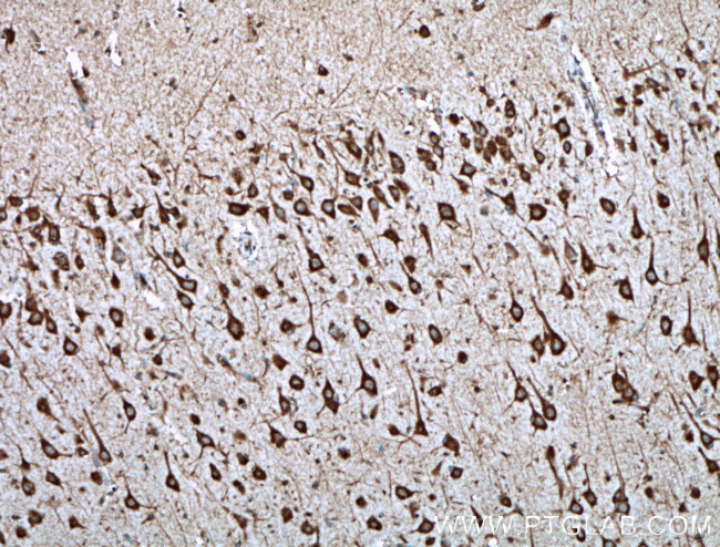 TREM2 Antibody in Immunohistochemistry (Paraffin) (IHC (P))