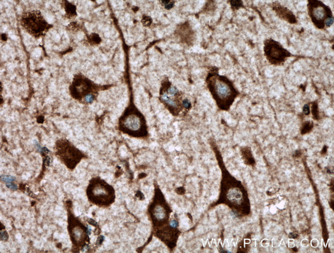 TREM2 Antibody in Immunohistochemistry (Paraffin) (IHC (P))