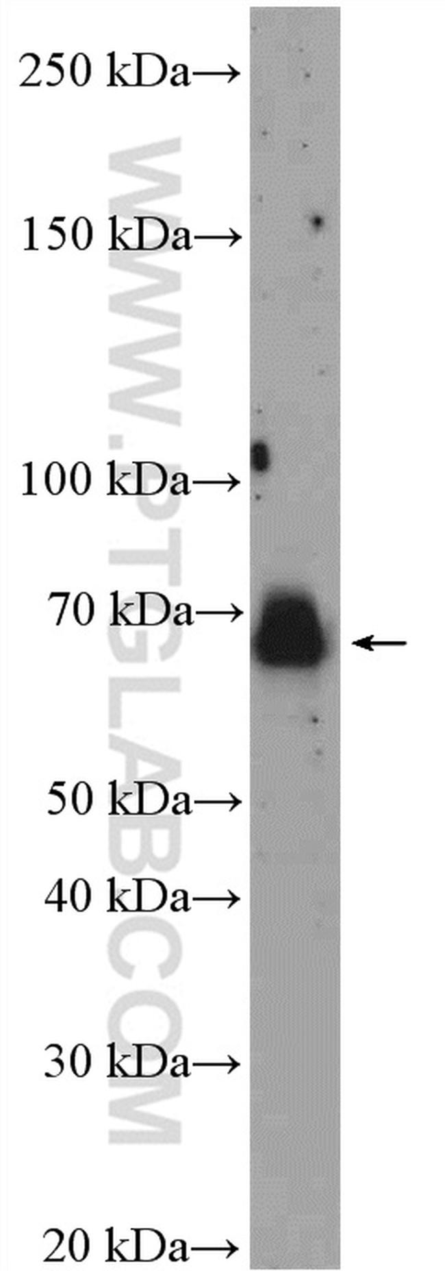 E2F3 Antibody in Western Blot (WB)