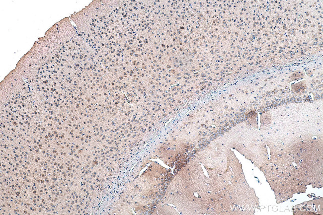 OPRM1 Antibody in Immunohistochemistry (Paraffin) (IHC (P))