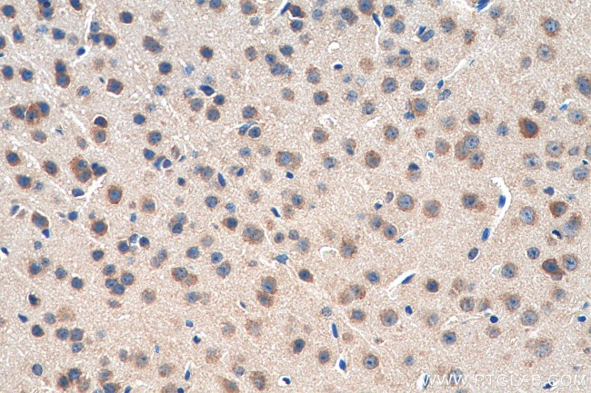 OPRM1 Antibody in Immunohistochemistry (Paraffin) (IHC (P))