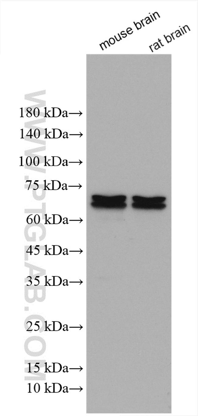 OPRM1 Antibody in Western Blot (WB)