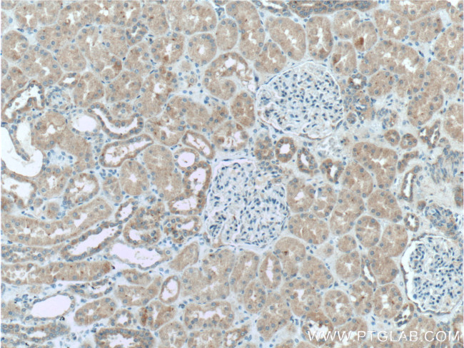 GSDMC Antibody in Immunohistochemistry (Paraffin) (IHC (P))