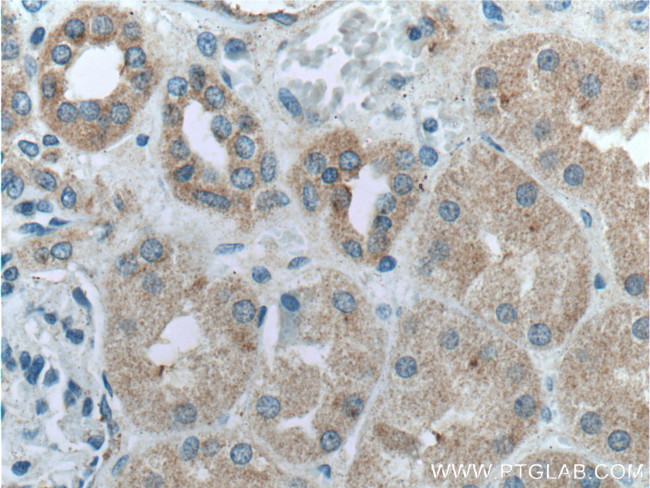 GSDMC Antibody in Immunohistochemistry (Paraffin) (IHC (P))