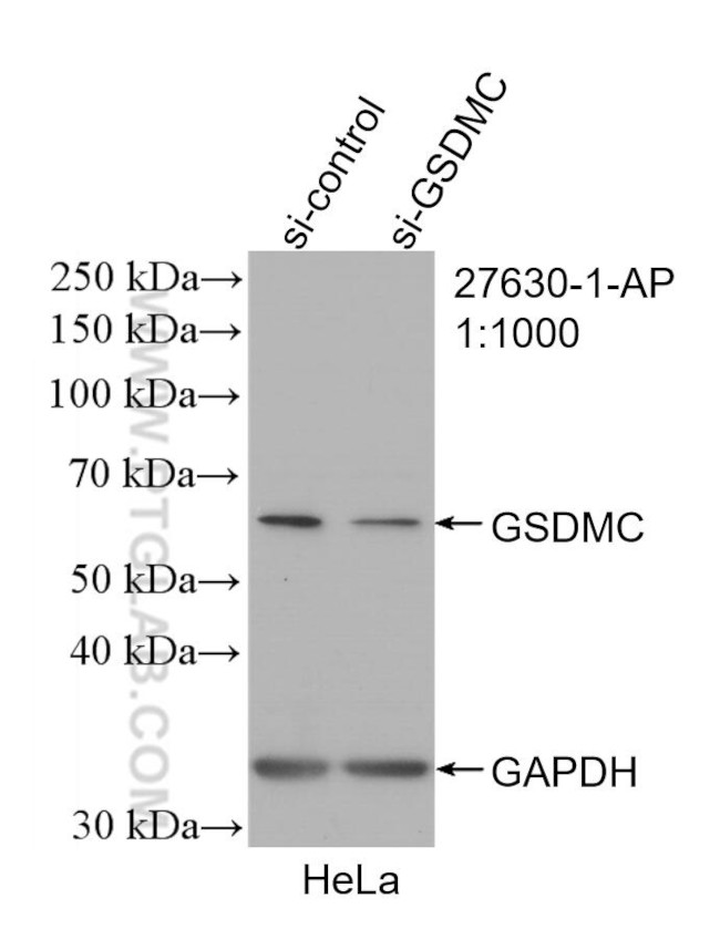 GSDMC Antibody in Western Blot (WB)